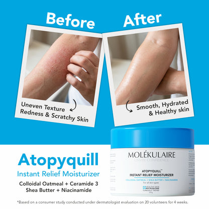 Atopyquill Instant Relief Moisturizer 200g